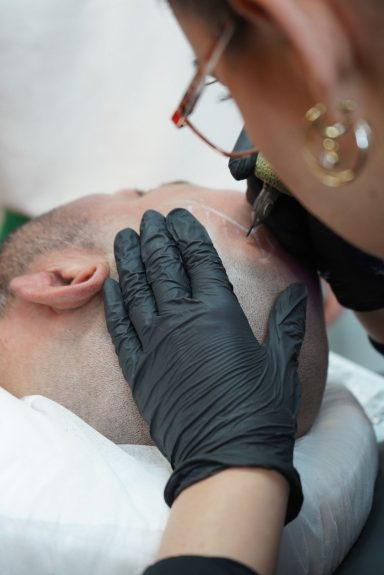 SMP Kopfhautpigmentierung